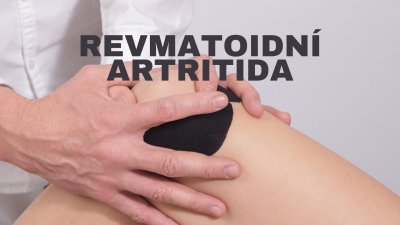 Reumatoidná artritída: Príznaky, liečba, a aká je prevencia? | ARNO-obuv.sk - obuv s tradíciou